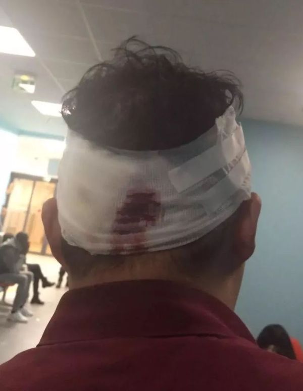 巴黎小偷多为什么没有人管,法国巴黎小偷太猖狂