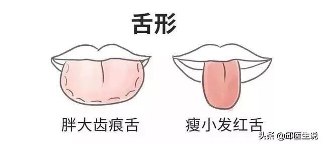 解决身体的湿气的偏方,本人湿气较重怎么能快速除湿气