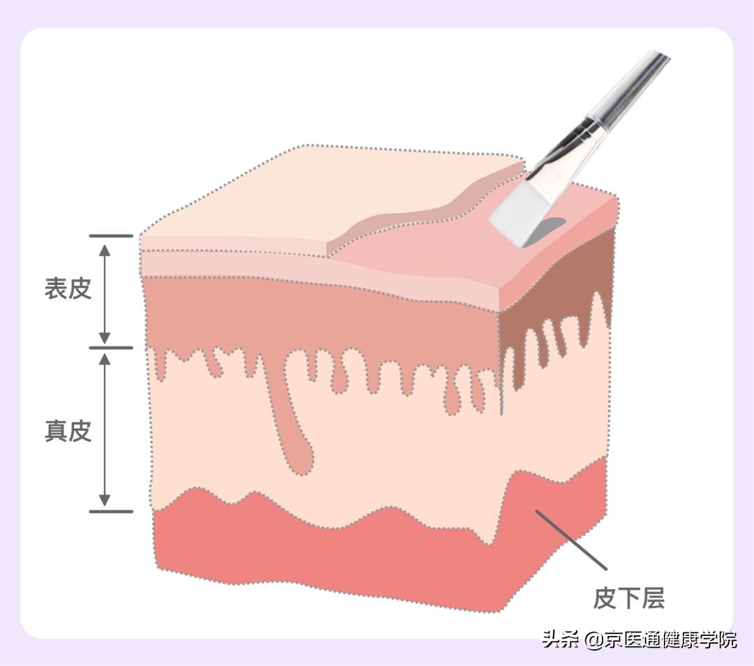 毛孔粗大的原因及改善方法,毛孔粗大的原因和治疗方法