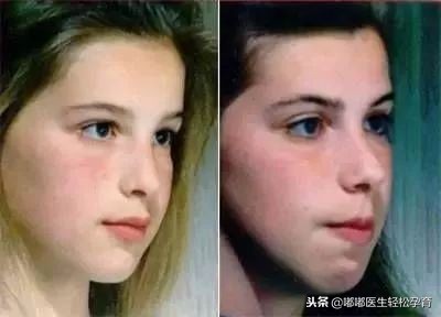 双胞胎姐姐长歪了!只因她用错呼吸方式!