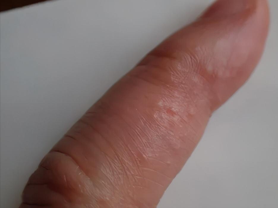 我们经常说的“湿气重”,到底说的是什么?