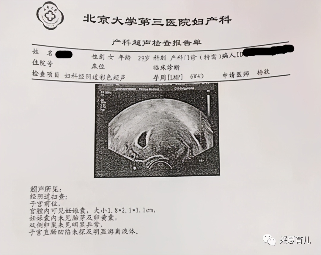 初次B超｜未见胎心胎芽，怎么办？