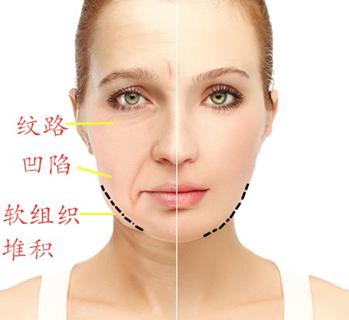 年纪越大脸就会越小是真的吗,如何判断自己是鹅蛋脸还是方脸