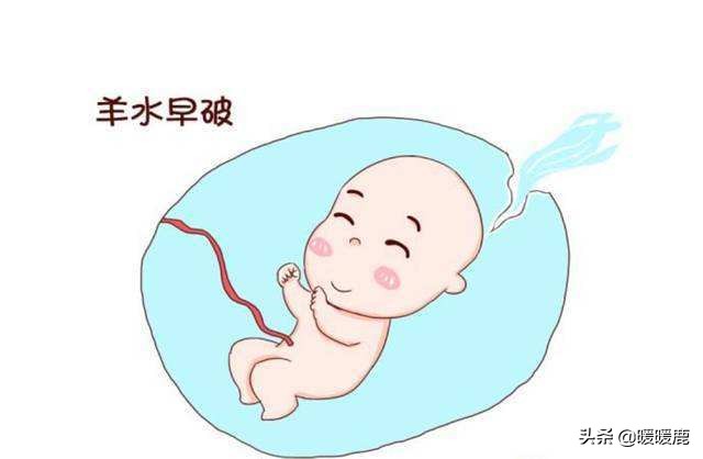 羊水过多的原因分析,羊水浑浊的原因和解决方法