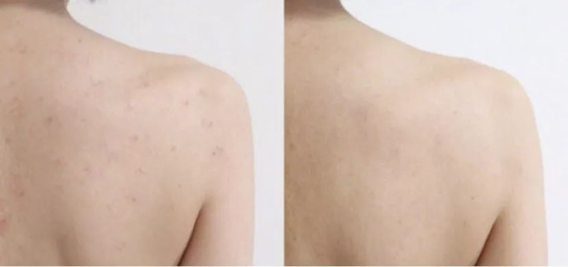 在超市看到这些东西一定要买,这几类护肤品不要多买