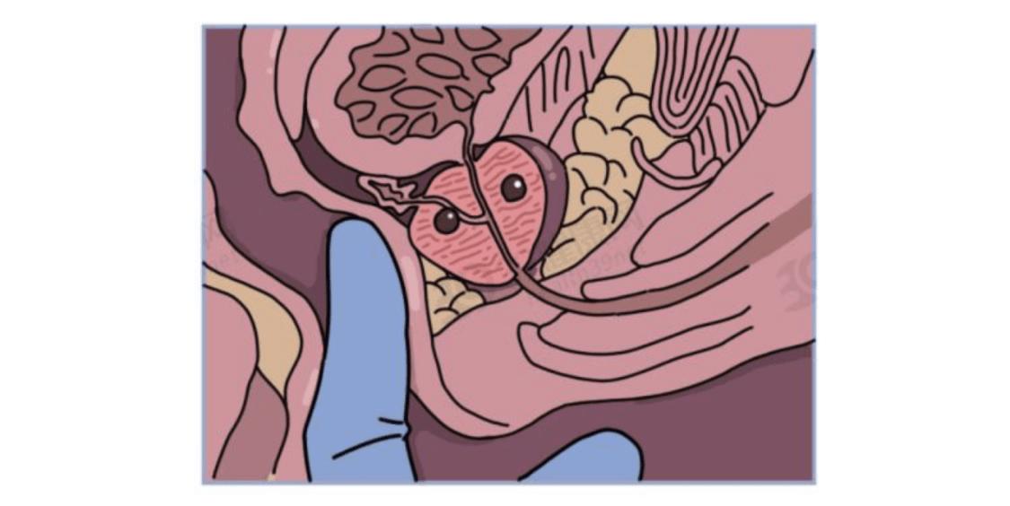 大“菊”为重，别再因为恐惧，错失这些疾病的确诊机会