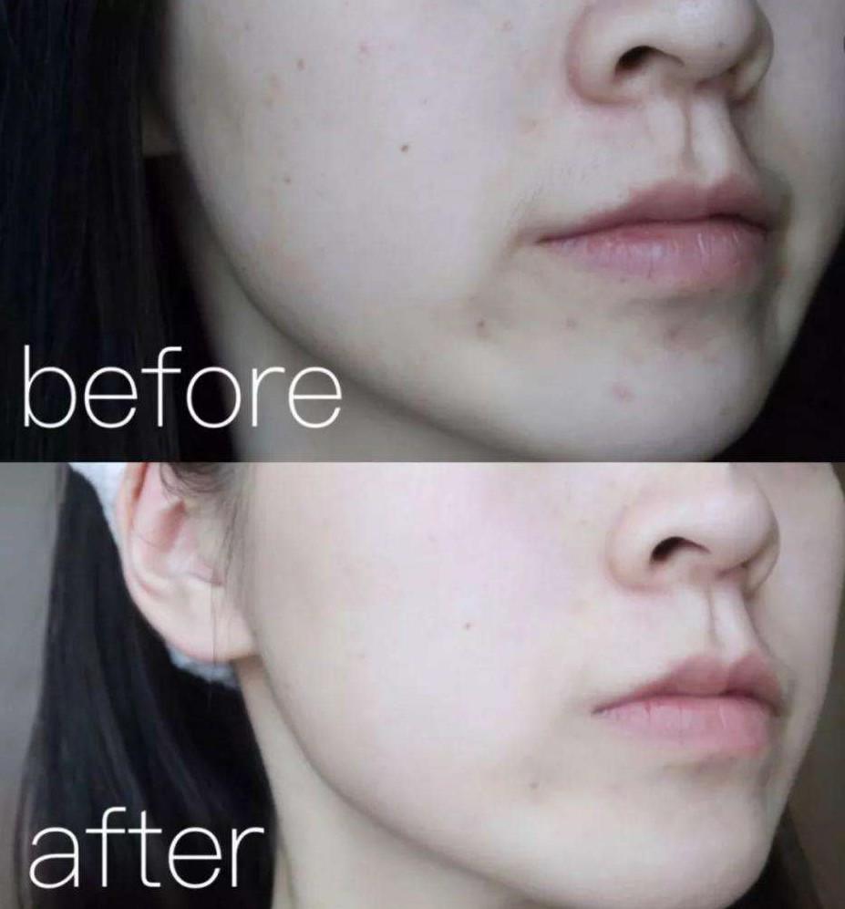 自制面膜效果好吗,自制面膜真的有效果吗