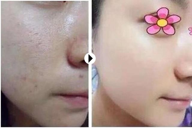 干得起皮泛红怎么办,皮肤干燥拯救大干皮