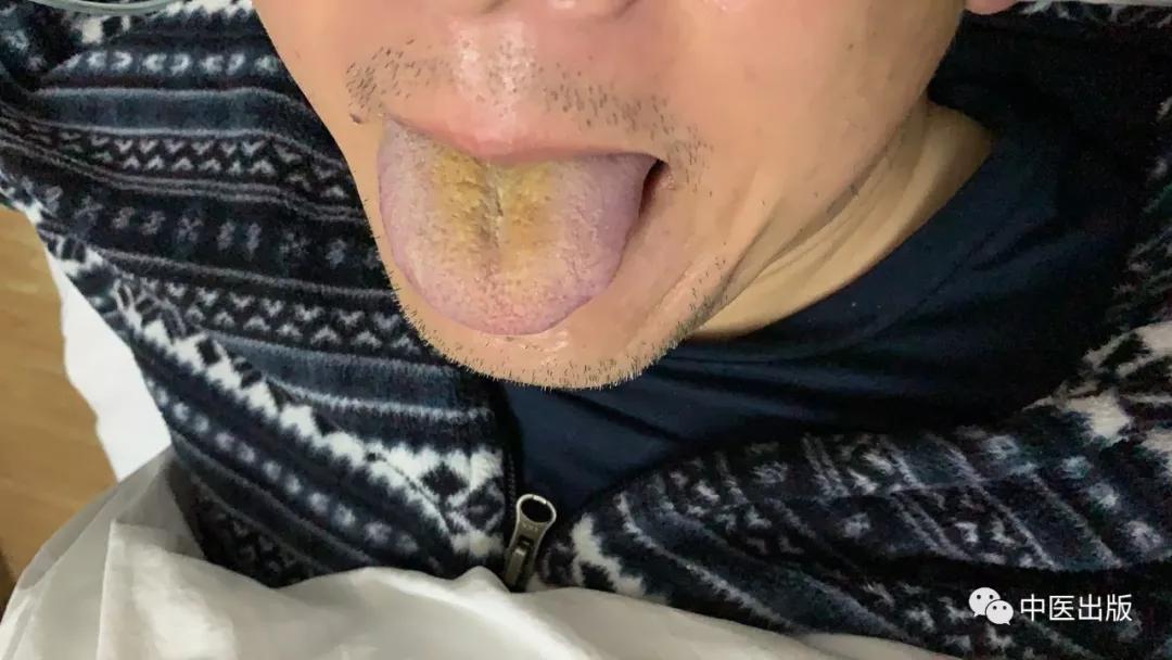 家里消毒用什么方法最好,医生建议家里用什么消毒