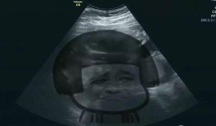 大姨妈晚了一周没来,月经晚了一个星期没测出怀孕