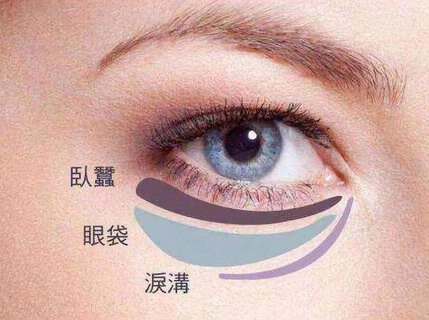 消除烦人眼袋黑眼圈的7个方法,黑眼圈眼袋重最有效的去除土方法