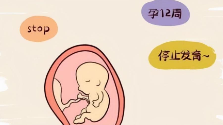 由于免疫抗体引起的胎停怎么保胎,免疫力太强会导致停胎