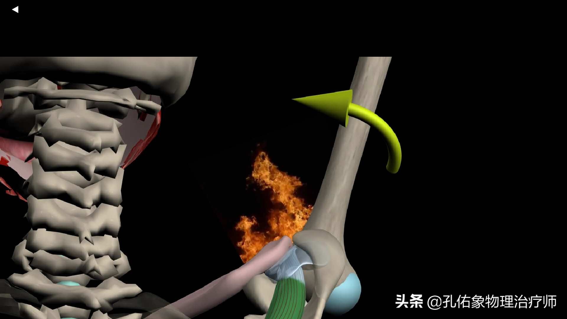 什么原因引起肩周炎手臂活动受限,引起肩周炎疼痛是什么原因