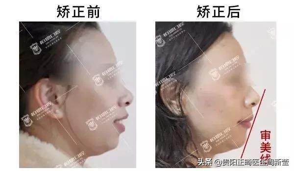 嘴形状看面相,嘴型区分