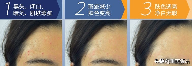 小灯泡美白精华skii有效果吗,sk小灯泡美白效果好吗