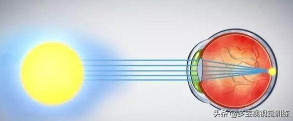 VR是怎样治疗斜弱视的?你知道吗?