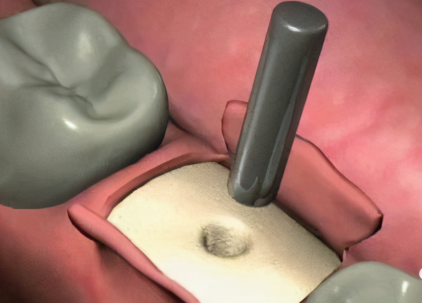 上海雅悦齿科种植牙价格,雅悦齿科医院简介