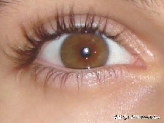眼球人体解剖学讲解,眼睛解剖讲解