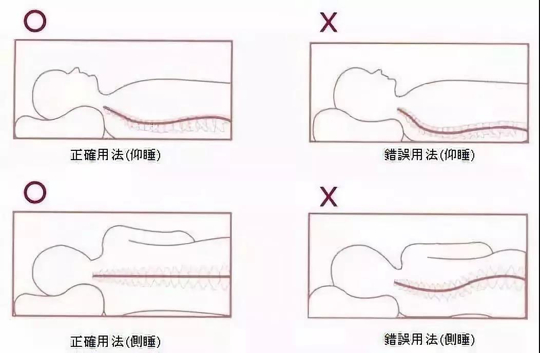 脖子后面鼓个包疼咋回事,脖子后面有结节说明颈椎病严重吗
