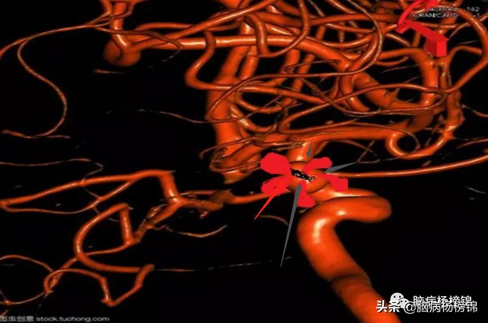 意外伤害很严重年纪轻轻难保命，谭院刀刀用真情豫南名医中中中