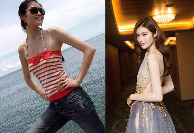 艾芙芷指南：天生皮肤黑的人，可以后天变白吗？