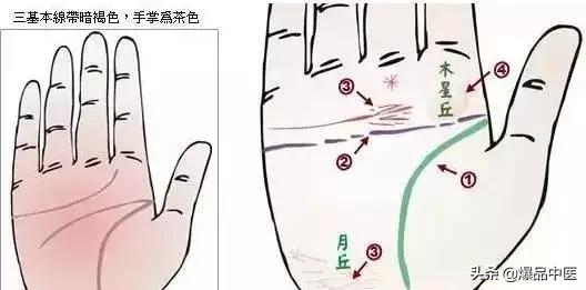 手诊图大全清晰图手背,全息手诊图