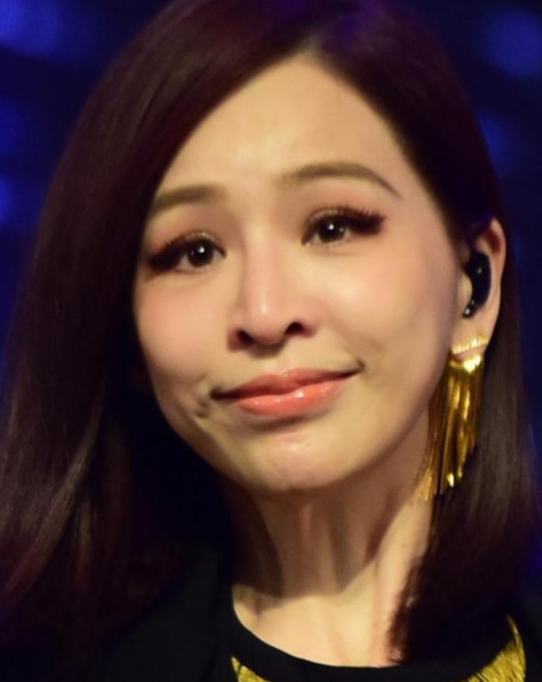 打玻尿酸显老网红,打玻尿酸成功的明星