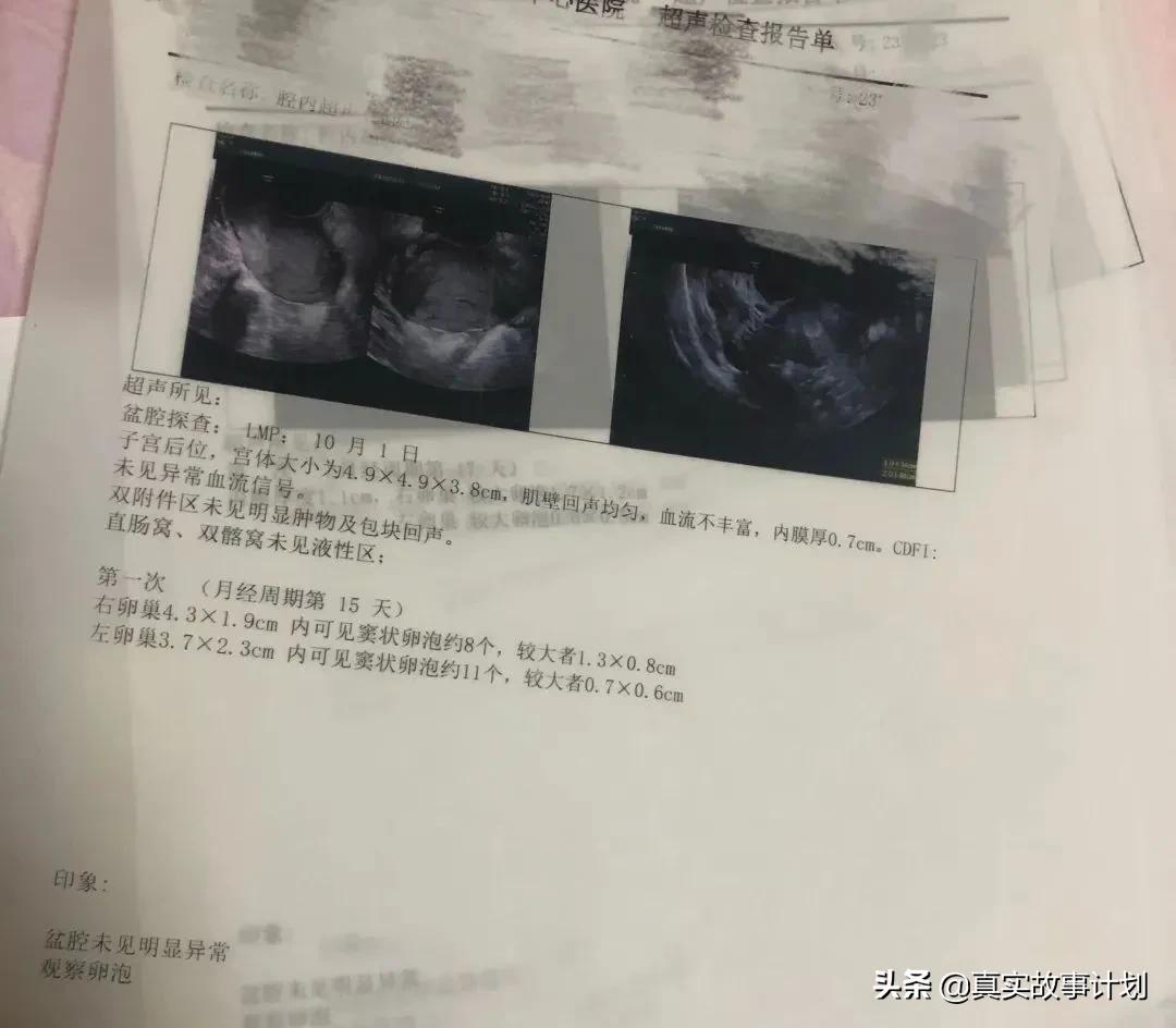 久备不孕生娃的新烦恼,久备不孕需要去医院检查什么项目