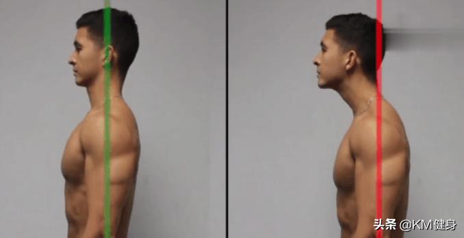 4个动作告别颈部皱纹,如何改变颈部前伸