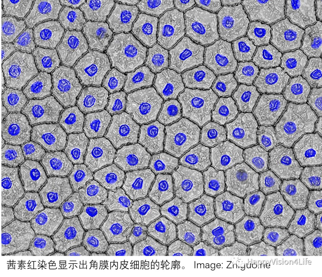 洞察超乳术后角膜的水肿