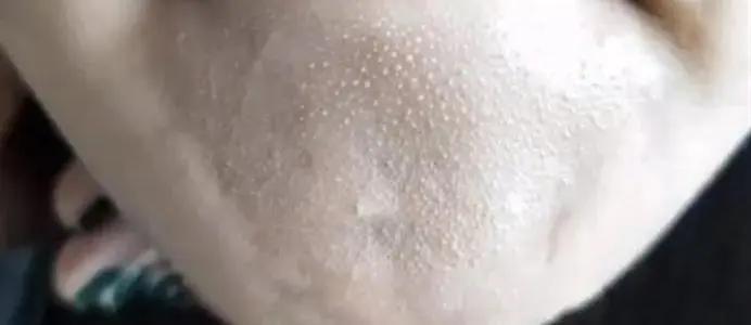 好皮肤怎么样养成的,好脸蛋