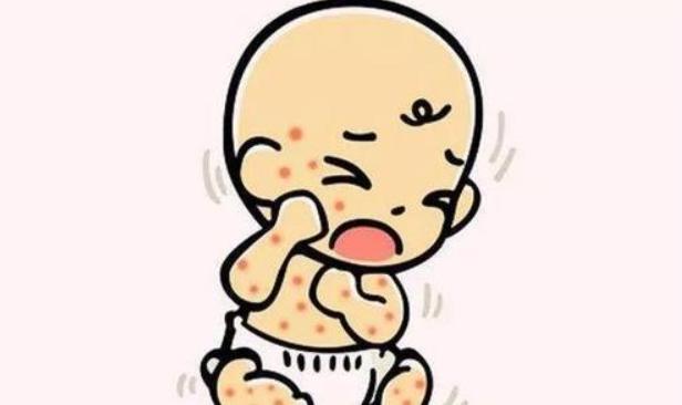 宝宝湿疹怎么办才好得快,宝宝得了湿疹怎么处理好得快
