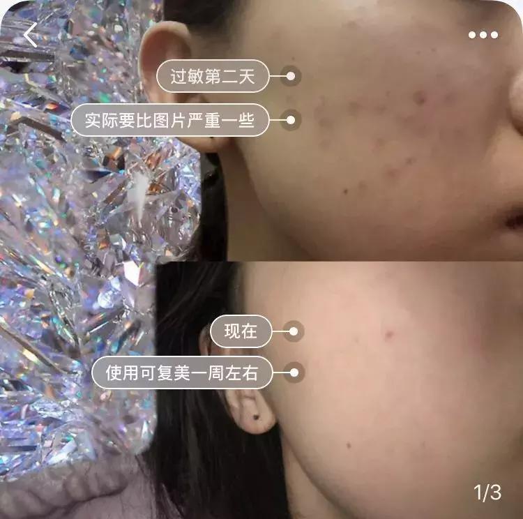 年度爱用好物面膜,盘点爱用面膜