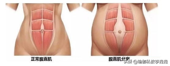 产后多少天可以做修复瑜伽,瑜伽产后修复初级教程在家练