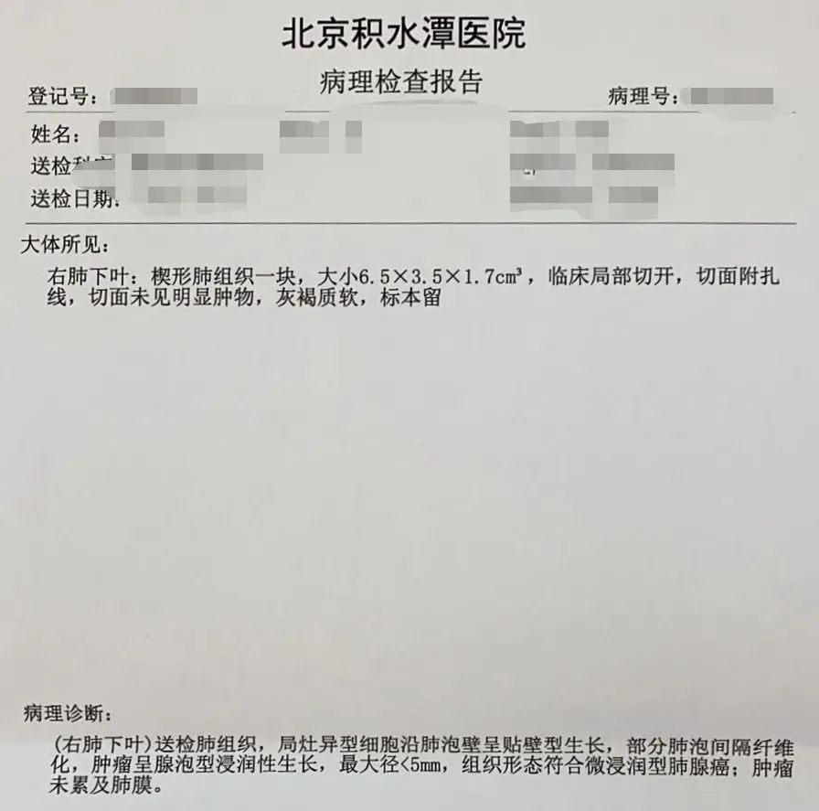 肺结节多学科联合诊疗,多学科会诊肺结节