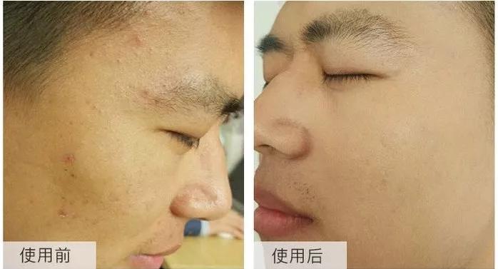 毛戈平遮瑕手法李佳琦 (毛戈平遮瑕李佳琦)