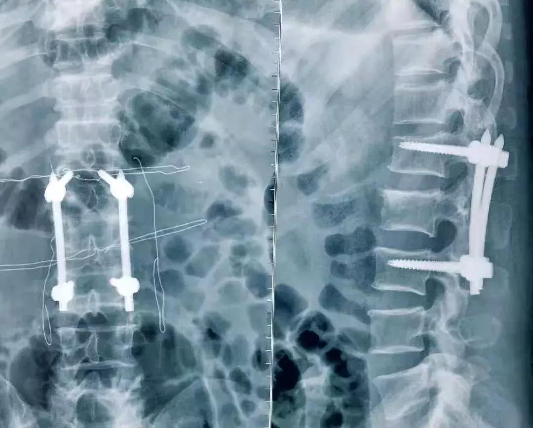 锦州发明专利,锦州实用新型专利