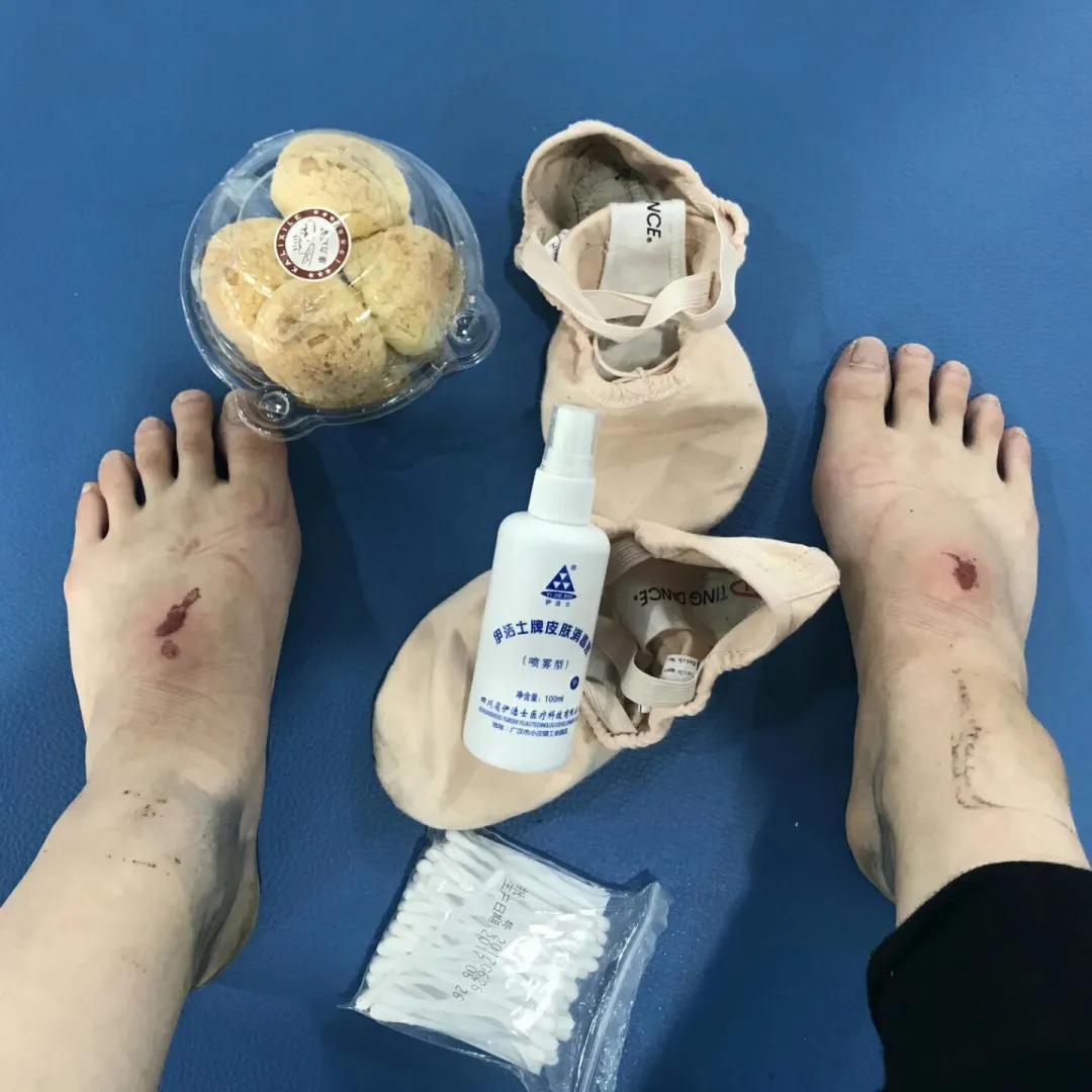 舞蹈如何快速提高软开度,舞蹈生怎么提高软开度