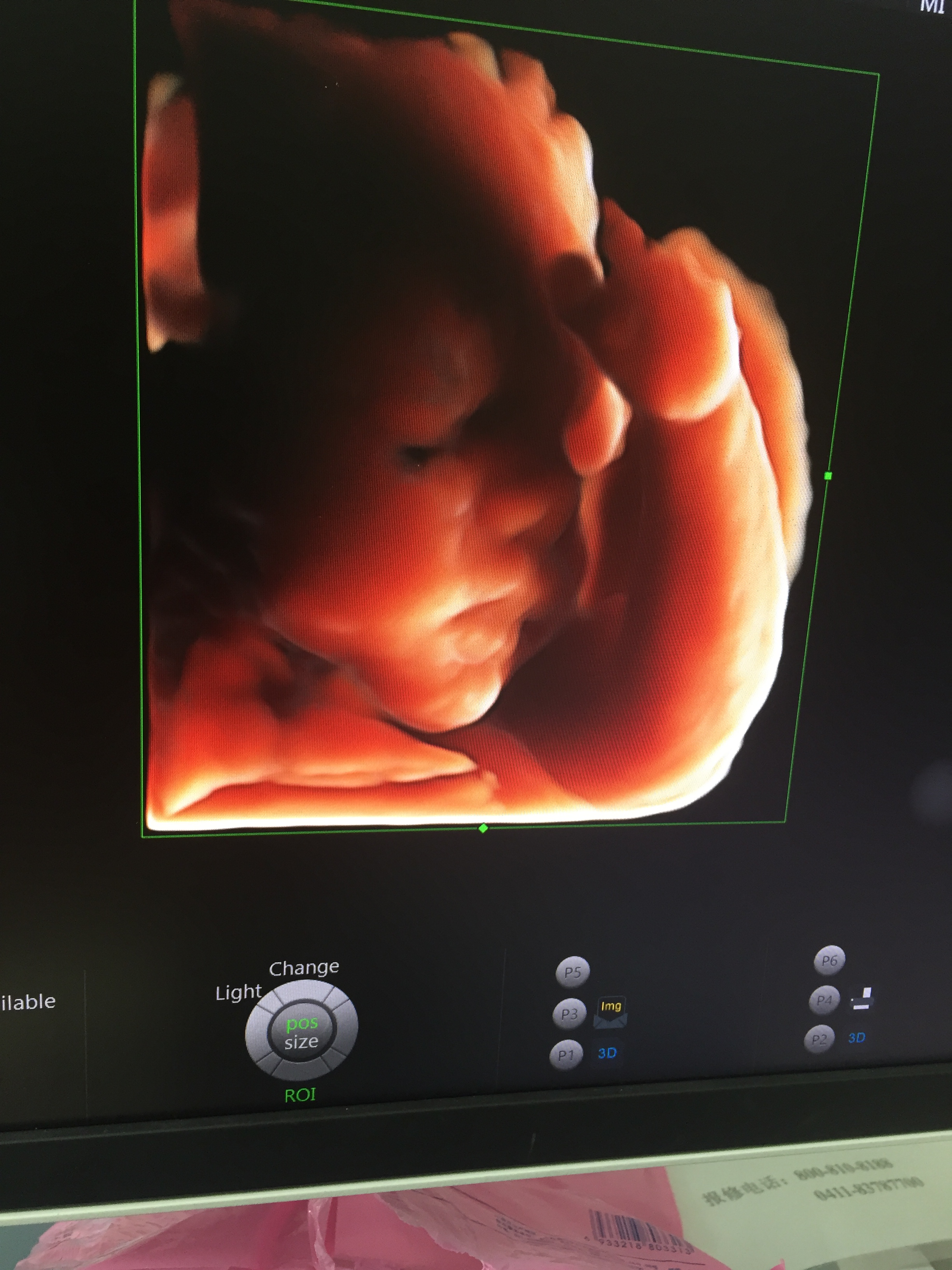 一份营养合理的一日食谱,学生营养餐一日食谱视频