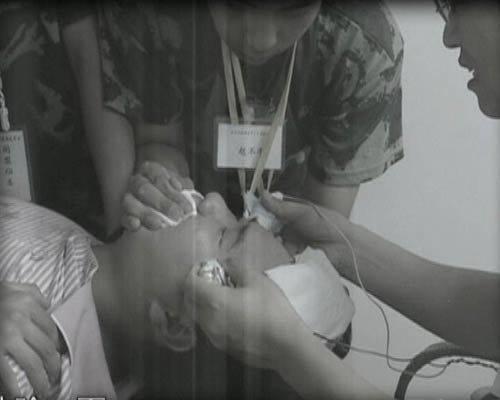 电击恶魔杨永信,杨永信电击的孩子后遗症