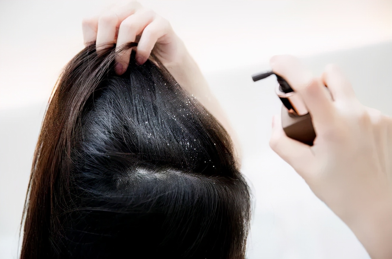 张柏芝早期发际线形状,张柏芝完美发际线