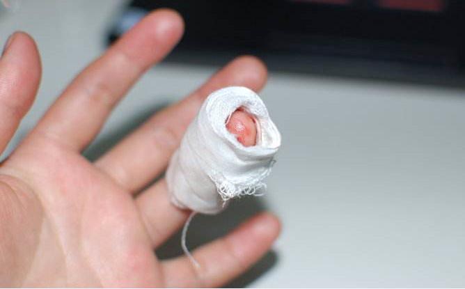 突如其来的高烧39度,儿童突如其来高烧