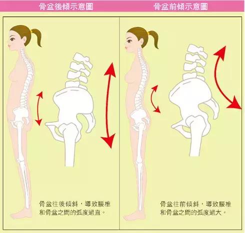 第三次做骨盆调理,稳定骨盆最简单的办法