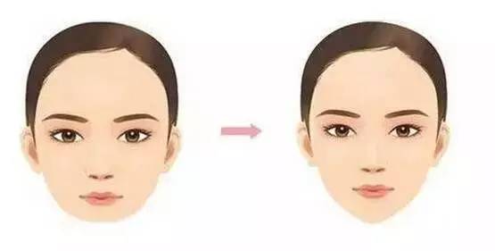 双下巴上有一坨肉向外凸,下巴多了一坨肉往前翘是太胖了吗