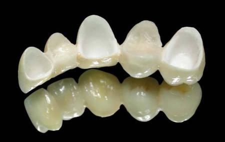 烤瓷牙崩瓷了怎么办,烤瓷牙崩瓷概率高吗