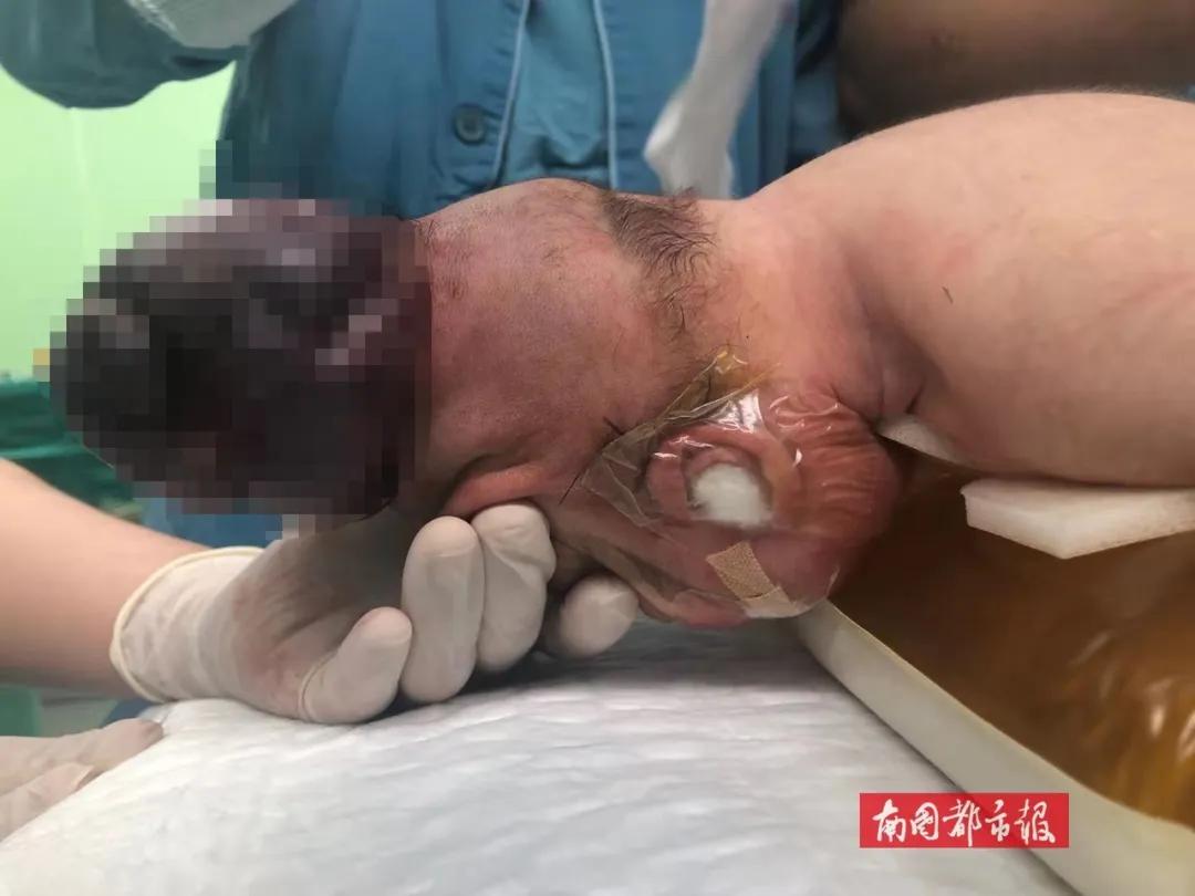 心疼妈妈生产的宝宝,心疼生孩子的妈妈