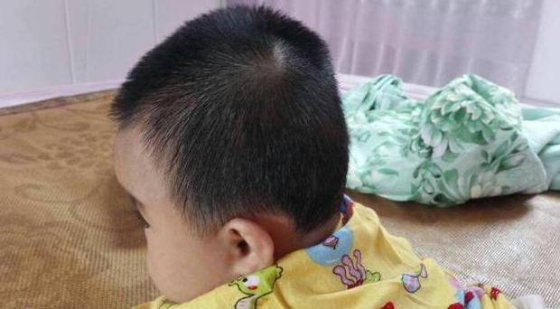 5个月宝宝后脑勺睡平了怎么纠正,5个月宝宝后脑勺扁平怎么办