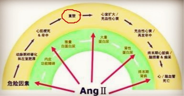 心肌重构能够有效逆转吗,心梗后多长时间心肌重构