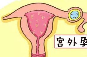 怀孕40天有点轻微出血是宫外孕吗,怀孕40天如何排除宫外孕