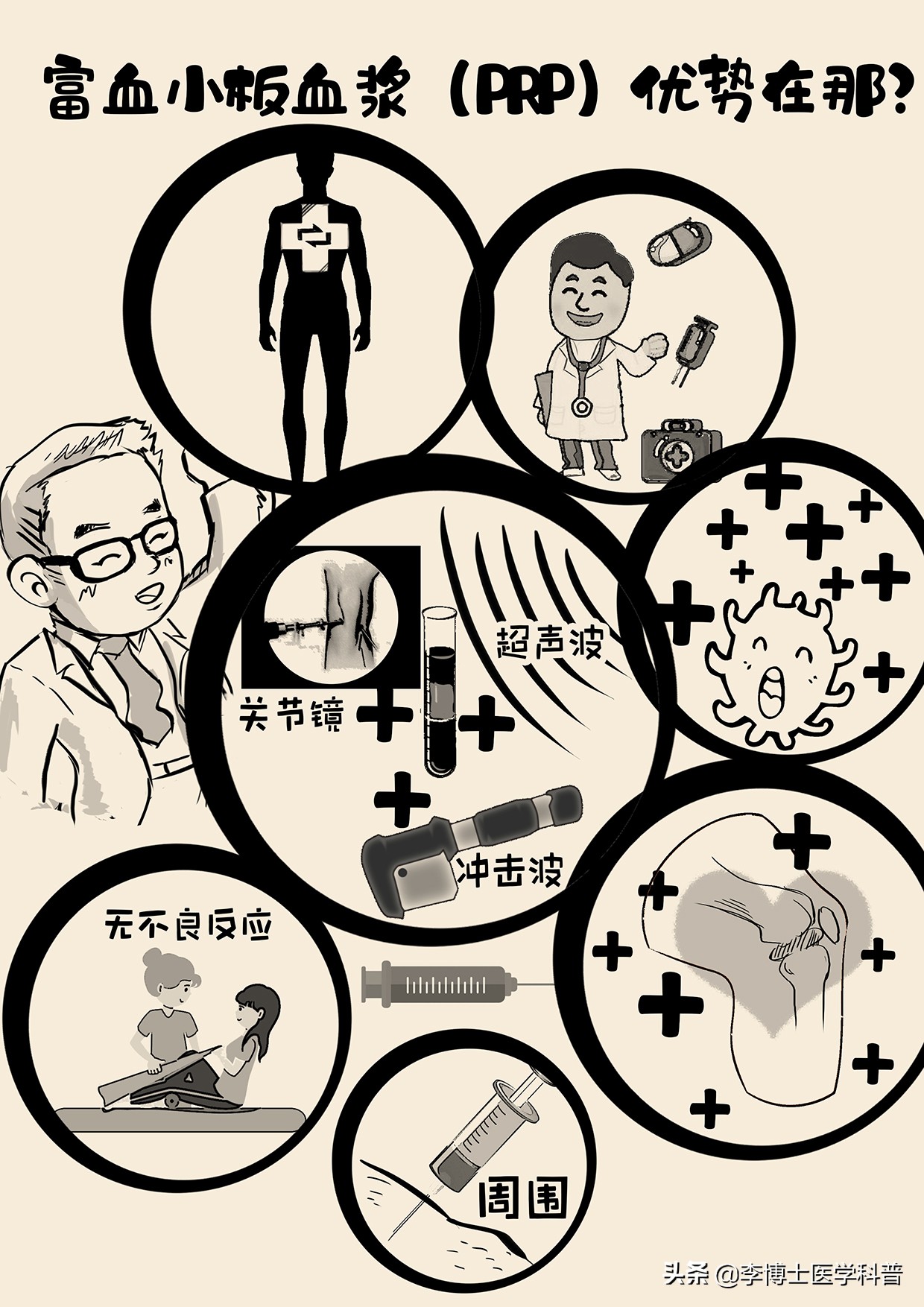 原创科普：富血小板血浆（PRP）技术的优势在那里？